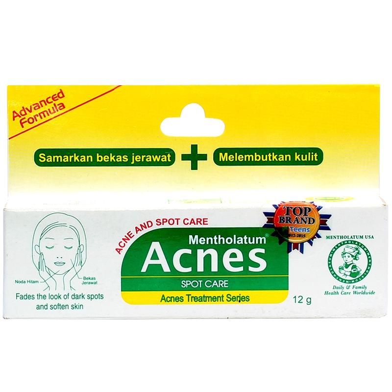 Review Mentholatum Acnes Spot Care Mentholatum